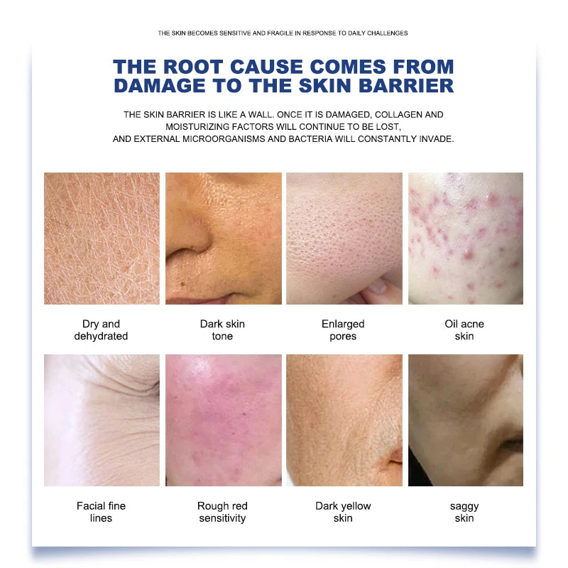 Newest Hydration Brightening Beauty Machine for Home Use Facial Care Equipment with Oxygen Jet Peel and Firming Dermabrasion