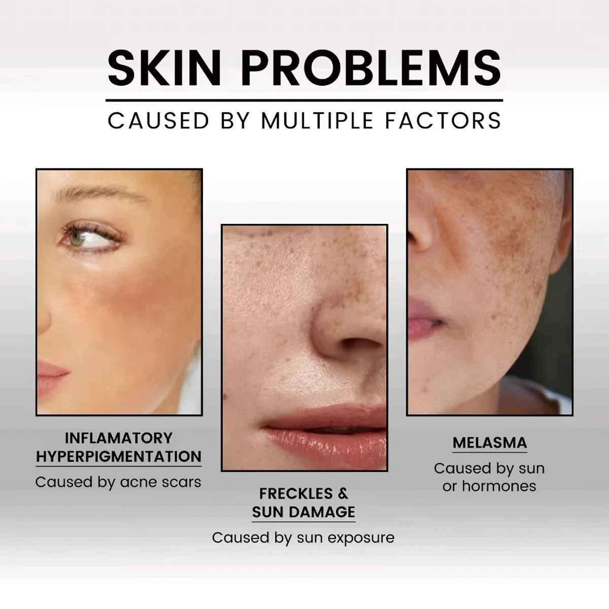 New 100% Pure Natural Vitamin E Oil Face Body Massage Spa Avocado Essential Oils Cold Pressed Moisturizer Serum | Kimlud...