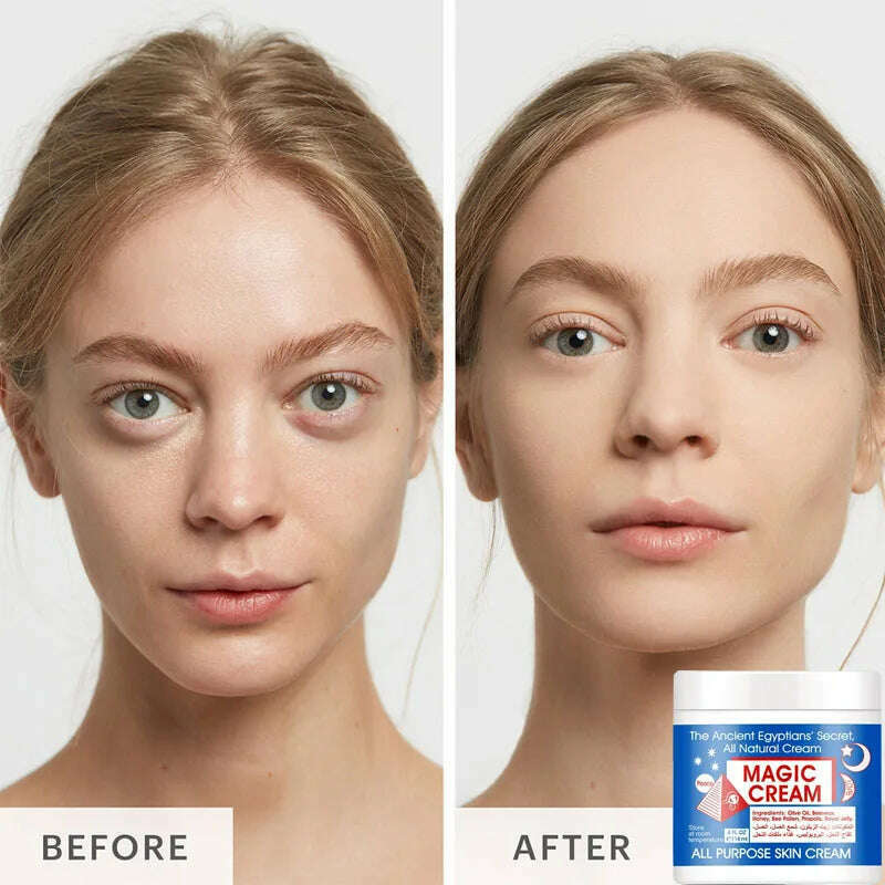 Magic Wrinkle Remover Face Cream Anti-Aging Fade Fine Line Lifting Firming Whitening Moisturizing Beauty Skin Care Cosmetic 118g