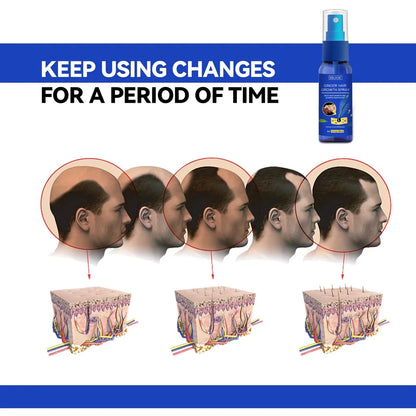 Ginger Hair Growth spray Anti Hair Fall Hair Loss Treatment Hair Growth Essence Oil for Men Women hair treatment - Kimlud