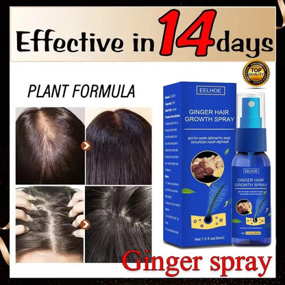 Ginger Hair Growth spray Anti Hair Fall Hair Loss Treatment Hair Growth Essence Oil for Men Women hair treatment - Kimlud