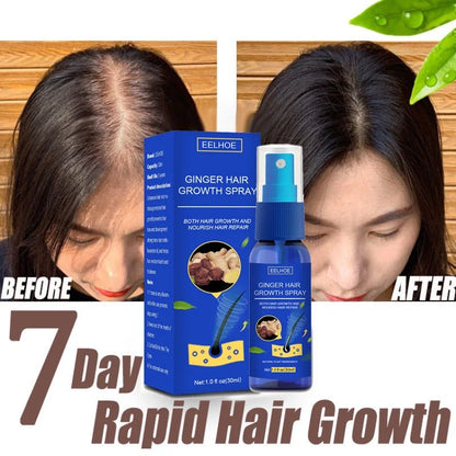 Ginger Hair Growth spray Anti Hair Fall Hair Loss Treatment Hair Growth Essence Oil for Men Women hair treatment - Kimlud