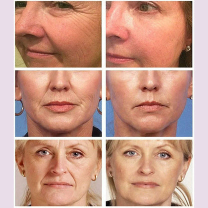 Magic Wrinkle Remover Face Cream Anti-Aging Fade Fine Line Lifting Firming Whitening Moisturizing Beauty Skin Care Cosmetic 118g