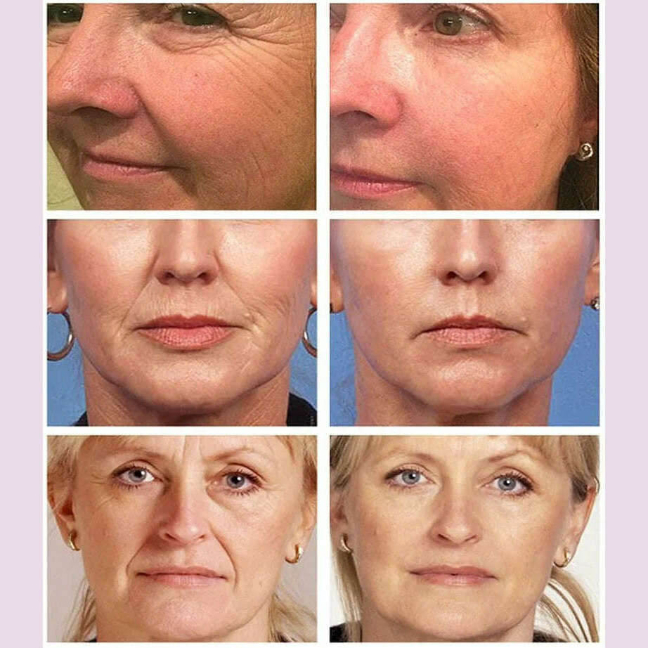 Magic Wrinkle Remover Face Cream Anti-Aging Fade Fine Line Lifting Firming Whitening Moisturizing Beauty Skin Care Cosmetic 118g